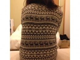 脊柱側弯症でお悩みのお客様の整体施術前の背中の状態