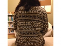 整体施術後の背中の状態。姿勢のバランスに変化が見られます