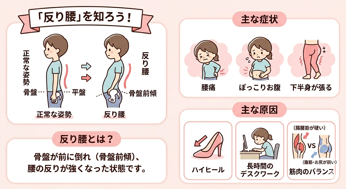 「反り腰を知ろう！」というタイトルの、反り腰に関する解説図。反り腰の定義、主な症状、主な原因をイラストとテキストでまとめています。